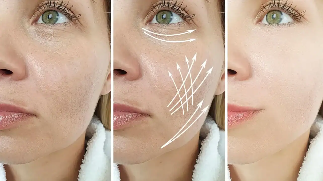 Can One Treatment Really Tackle More Than One Skin Concern Banstead?