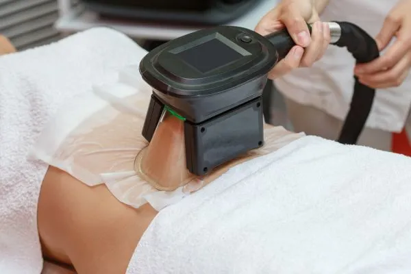 Image of person having fat freezing treatment to help weight gain Banstead