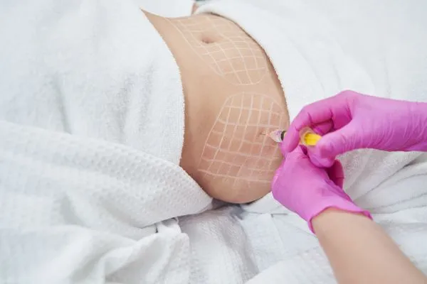 image of fat dissolving injections on love handles to help combat weight gain Banstead