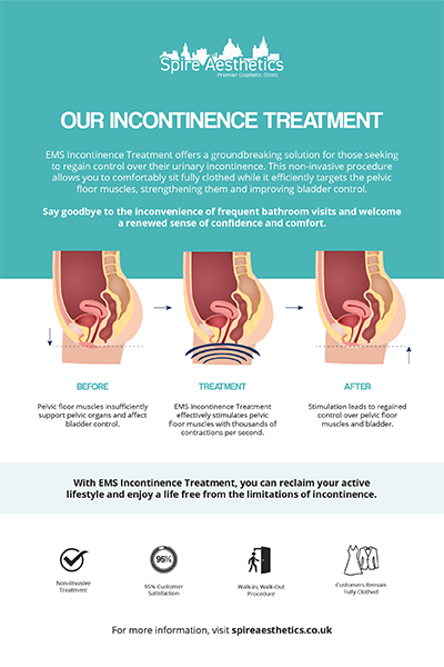 image to show how EMS treatment works for female urinary incontinence Banstead