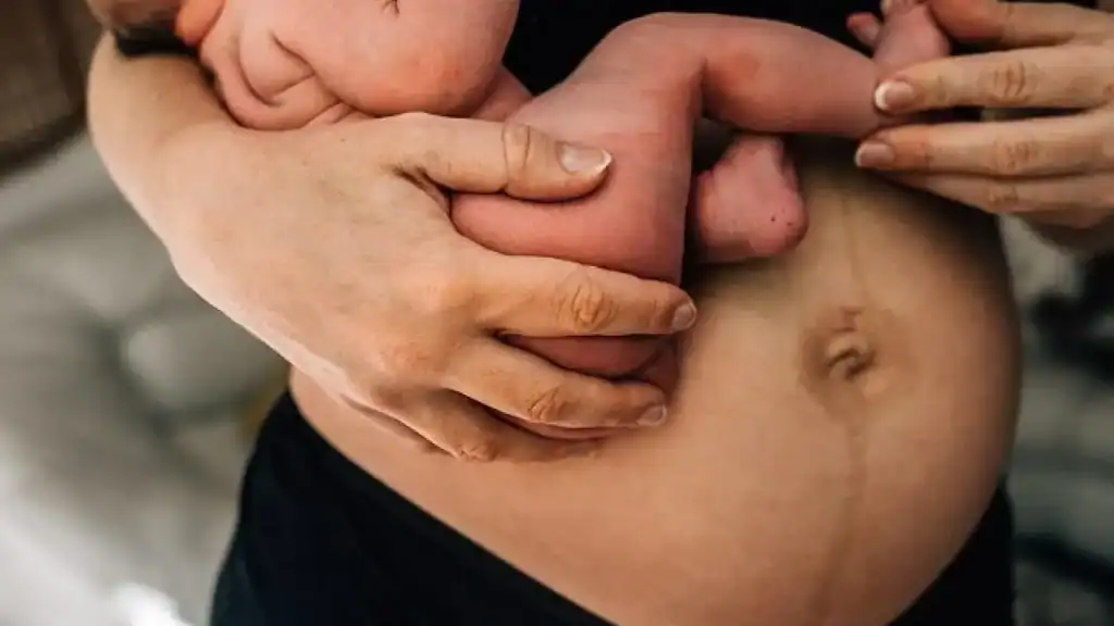 Why Is My Stomach Still Big After Pregnancy Banstead?